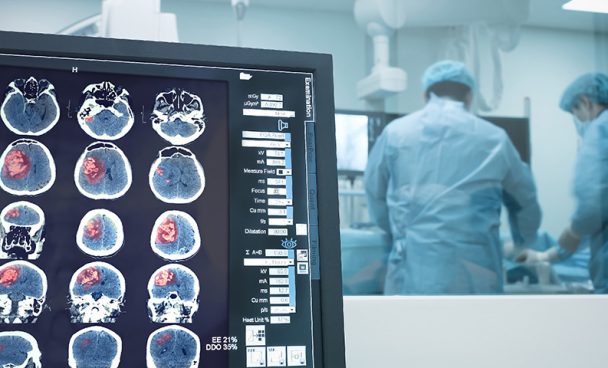 Cirurgia de Cabeça e Pescoço