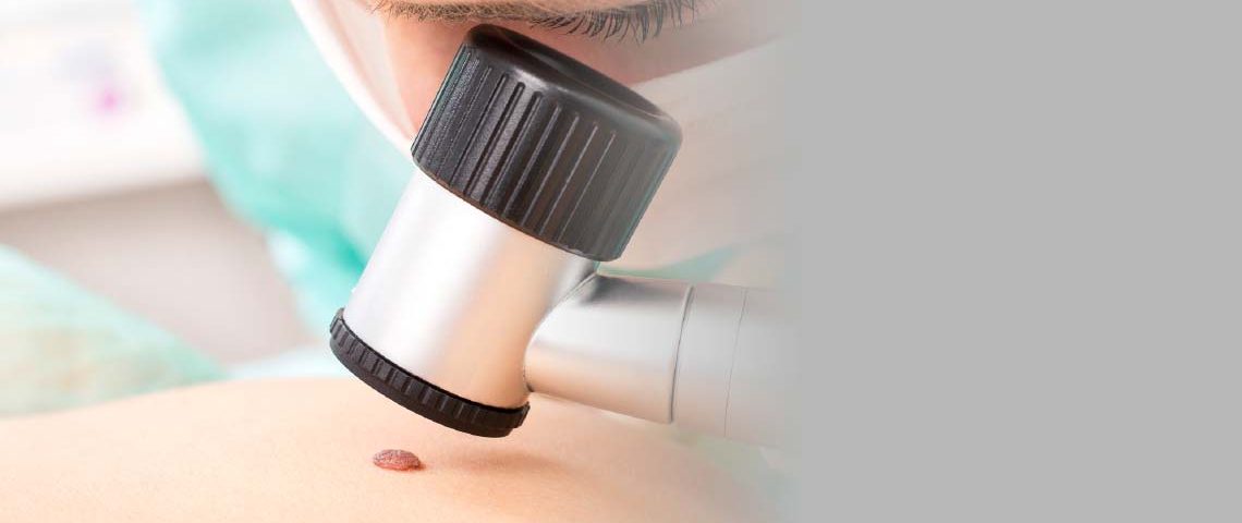 Estudo RELATIVITY 047 mostrou benefício estatisticamente relevante com uso de relatlimabe + nivolumabe quando comparado com a monoterapia com nivolumabe