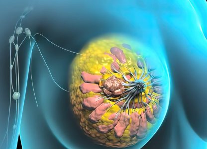 Câncer de mama RH+, câncer de pâncreas com ATM mut germinativo e MSI em câncer de pulmão